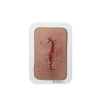 Pocketwound Surgical Wound half-open - clean wound