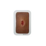 Pocketwound Keratinization - clean