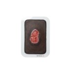 Pocketwound Granulation with Undermining