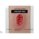 Pocketwound Hypergranulation deep