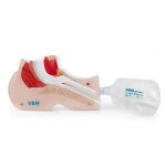 Airway View