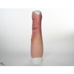 Sleeve Bein mit Gamaschenulkus - saubere Wunde, hell
