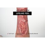 Sleeve Bein mit Gamaschenulkus - saubere Wunde, hell