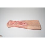 Sleeve Bein mit Gamaschenulkus - saubere Wunde, hell