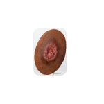 Stick-On Small Dekubitus 3. Grades - saubere Wunde