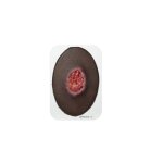 Stick-On Small Dekubitus 3. Grades - saubere Wunde