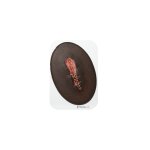 Stick-On Small OP-Wunde ge&ouml;ffnet - saubere Wunde
