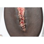 Stick-On Small OP-Wunde ge&ouml;ffnet - saubere Wunde