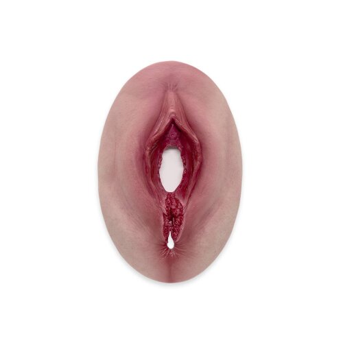 Stick-On Medium Fourth-Degree Perineal Tear