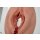 Stick-On Medium Fourth-Degree Perineal Tear
