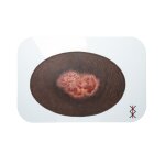 Stick-On Medium Dekubitus 2. Grades - saubere Wunde