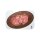 Stick-On Large Ulcer with Undermining - clean wound