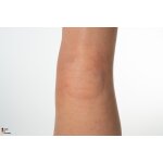 Base Model Leg without Wounds