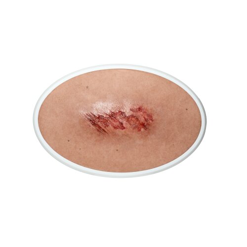 Frame Model Abrasion