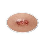 Frame Model Abrasion