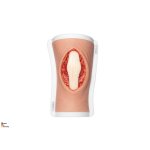 Knie mit 2 freiliegenden Sehnen, Patellasehne, Quadrizepssehne