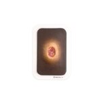 Pocketwound Hyperkeratosis - wound with coating