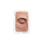 Pocketwound Xanthelasma (Lidkn&ouml;tchen) - mit Behaarung