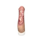 Sleeve Leg with Gaiter Ulcer - wound with coating