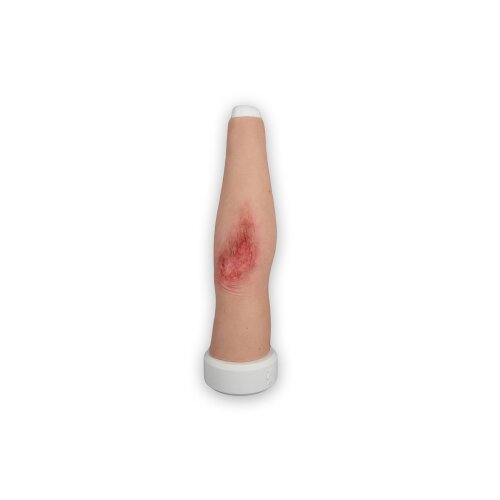 Sleeve Long Arm Abrasion Wound