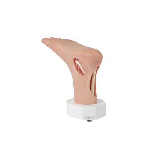 Fuß mit 2 freiliegenenden Sehnen, Achillessehne, Tibialis-posterior-Sehne