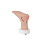 Fu&szlig; mit 2 freiliegenenden Sehnen, Achillessehne, Tibialis-posterior-Sehne