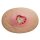 Stick-On Medium Pressure Ulcer Stage 3 - wound with coating