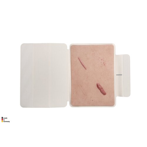 Tablet Wound Model 4 Scar Model Keloid Scar, Atrophic Scar, Normal Scar, Hypertrophic Scar