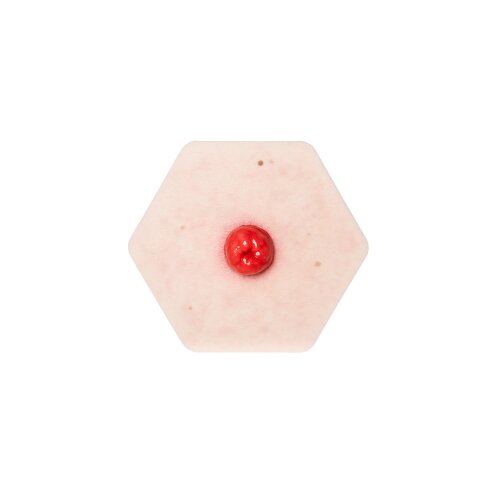 Hexapad Stoma perfekt