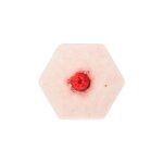 Hexapad Stoma mit Dehiszenz