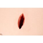 Wound Packing Simulator "Stich"