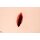 Wound Packing Simulator "Stich"