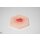 Hexapad Hypergranulation