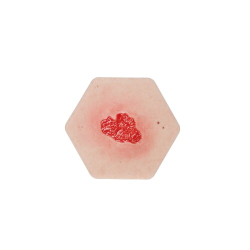 Hexapad Granulation