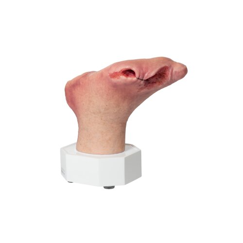 Base Model Diabetic Foot Syndrome with 7 Wounds - clean wound