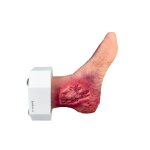 Base Model Diabetic Foot Syndrome with 7 Wounds - clean wound