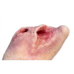 Base Model Diabetic Foot Syndrome with 7 Wounds - clean wound