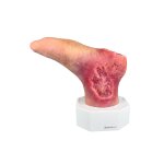 Base Model Diabetic Foot Syndrome with 7 Wounds - clean wound