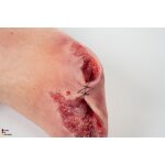 Base Model Diabetic Foot Syndrome with 7 Wounds - clean wound