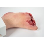 Base Model Diabetic Foot Syndrome with 7 Wounds - clean wound