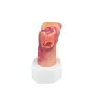 Base Model Diabetic Foot Syndrome with 7 Wounds - clean wound
