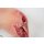 Base Model Diabetic Foot Syndrome with 7 Wounds - clean wound