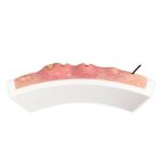 Rahmenmodell Hidradenitis Suppurativa (gebogener Querschnitt)