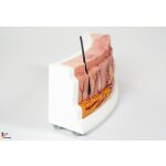 Rahmenmodell Hidradenitis Suppurativa (gebogener Querschnitt)