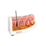 Rahmenmodell Hidradenitis Suppurativa (gebogener Querschnitt)