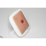Frame model Stoma in a hollow