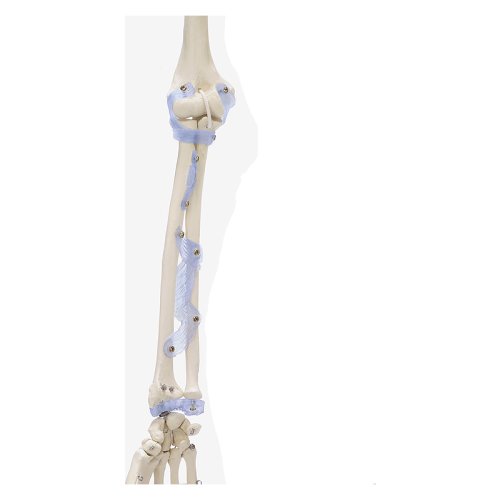 Skelett-Modell "Otto" mit Bandapparat