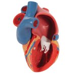 Heart Model with Representation of Systole, 5 parts - 3B Smart Anatomy
