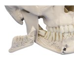 Dental-Sch&auml;del-Modell, 4-tlg