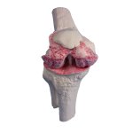 Knee implant model